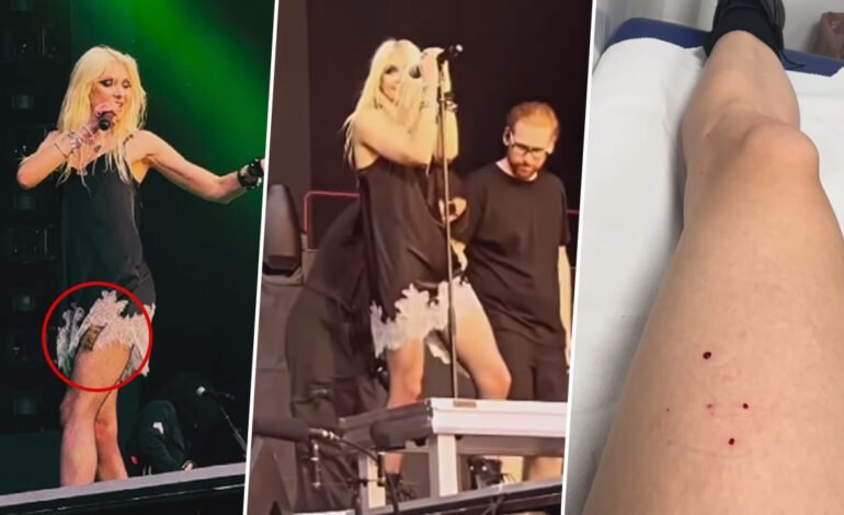 Taylor Momsen Bitten By a Bat While On Stage In Spain