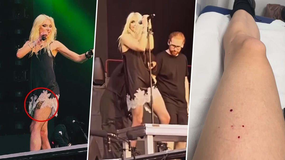 Taylor Momsen Bitten By a Bat While On Stage In Spain